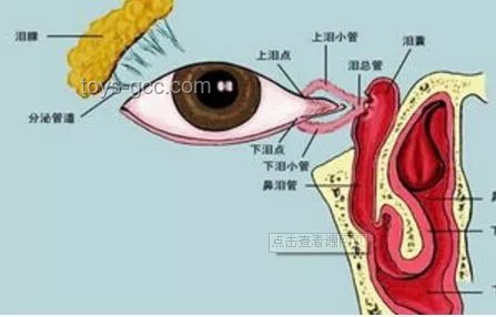 **泪囊异常症状对比：女子右眼狂飙泪与常见泪道疾病**